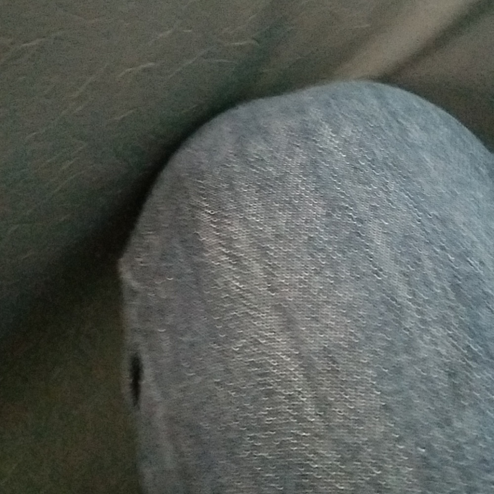 My friends knee